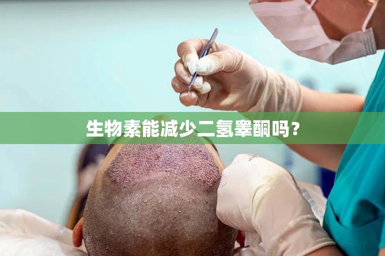 生物素能减少二氢睾酮吗？