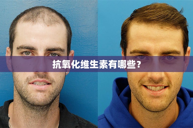 抗氧化维生素有哪些？