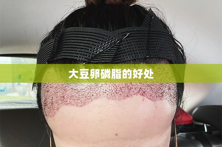 大豆卵磷脂的好处