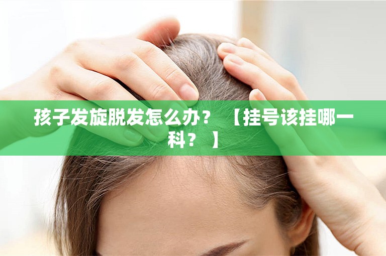 孩子发旋脱发怎么办？ 【挂号该挂哪一科？ 】