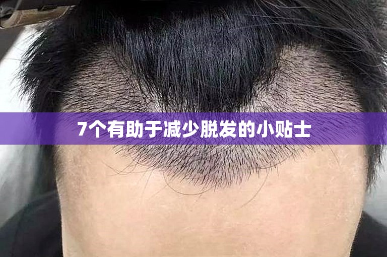 7个有助于减少脱发的小贴士