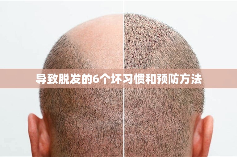 导致脱发的6个坏习惯和预防方法