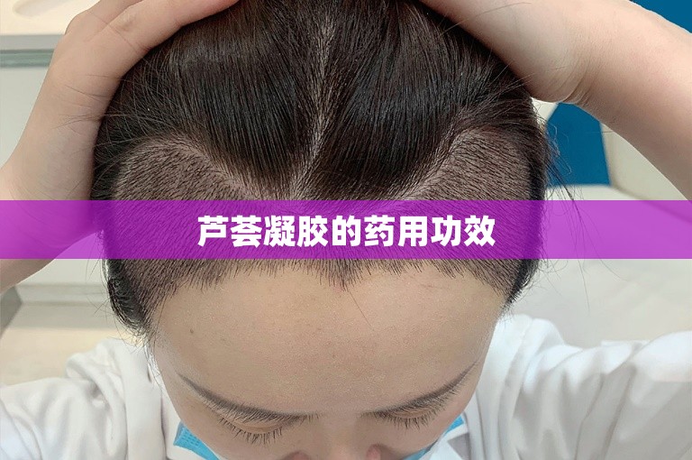 芦荟凝胶的药用功效