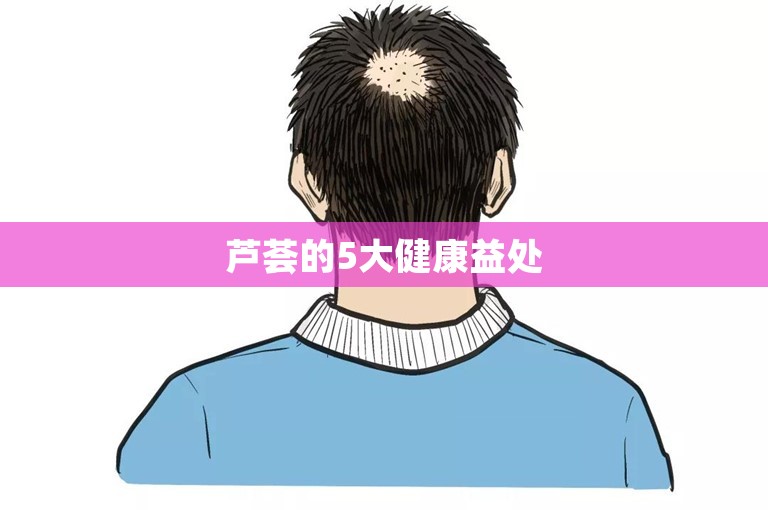 芦荟的5大健康益处
