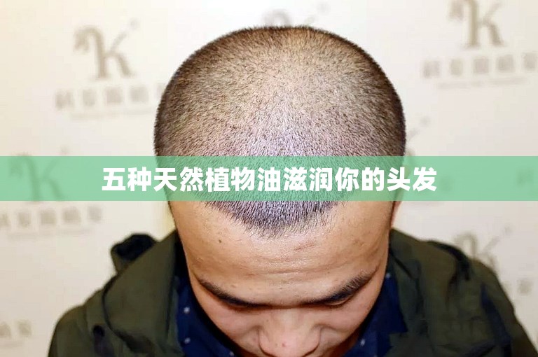 五种天然植物油滋润你的头发