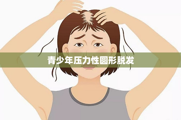 青少年压力性圆形脱发