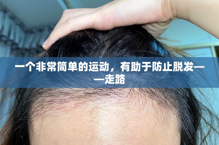 一个非常简单的运动，有助于防止脱发——走路