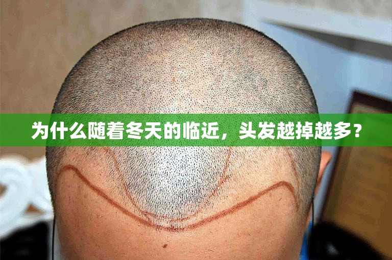 为什么随着冬天的临近，头发越掉越多？