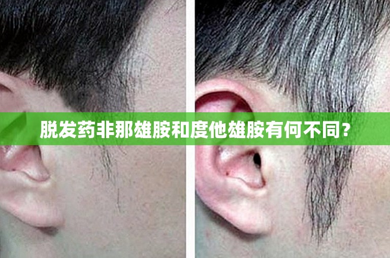 脱发药非那雄胺和度他雄胺有何不同？