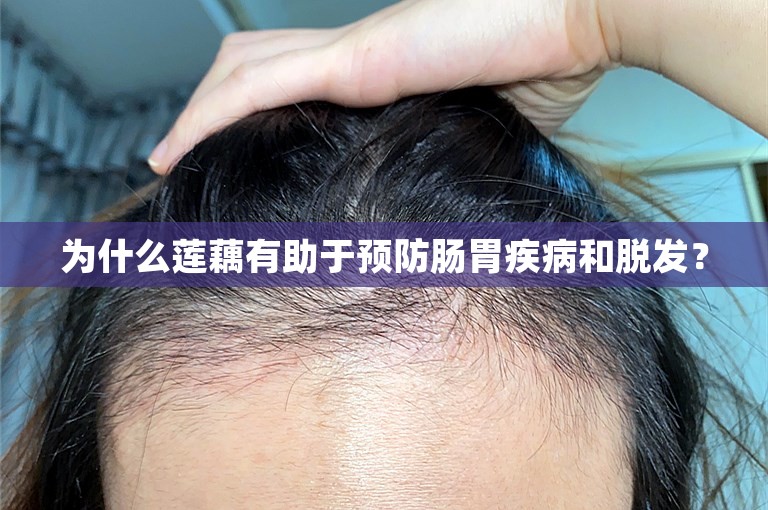 为什么莲藕有助于预防肠胃疾病和脱发？
