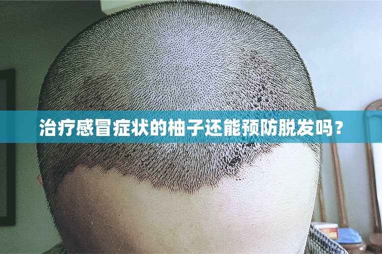 治疗感冒症状的柚子还能预防脱发吗？