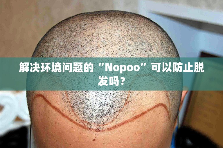 解决环境问题的“Nopoo”可以防止脱发吗？