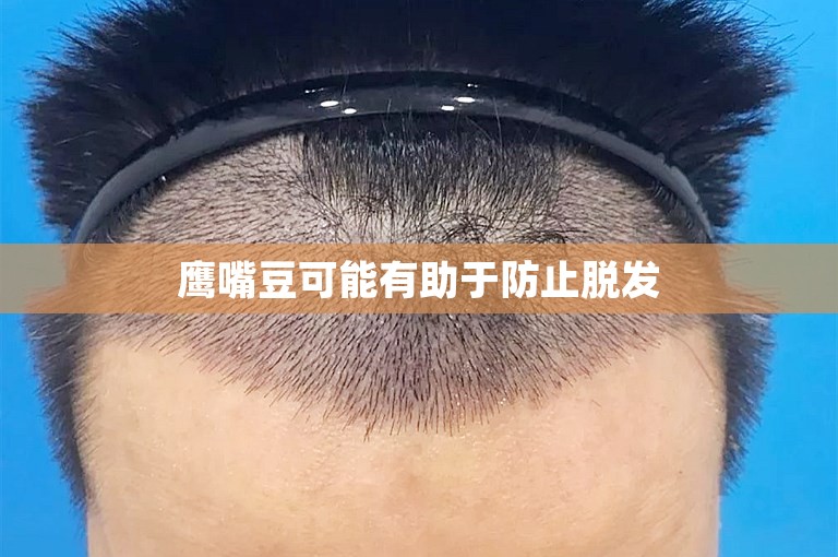 鹰嘴豆可能有助于防止脱发