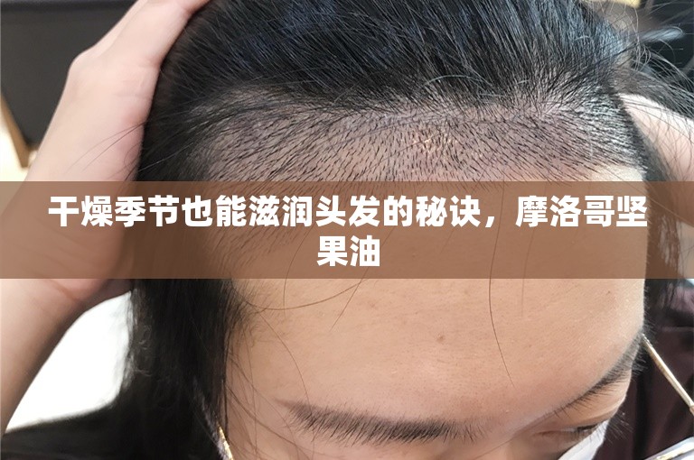 干燥季节也能滋润头发的秘诀，摩洛哥坚果油
