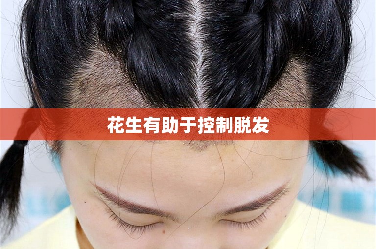 花生有助于控制脱发