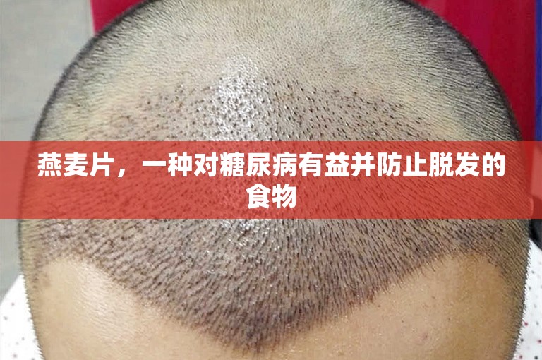 燕麦片，一种对糖尿病有益并防止脱发的食物