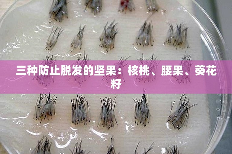 三种防止脱发的坚果：核桃、腰果、葵花籽