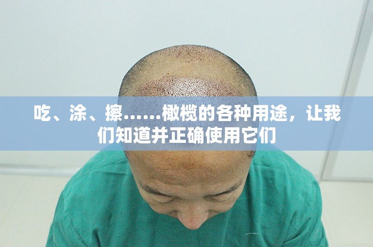 吃、涂、擦……橄榄的各种用途,让我们知道并正确使用它们 吃、涂、擦……橄榄的各种用途,让我们知道并正确使用它们