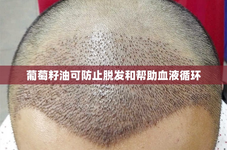 葡萄籽油可防止脱发和帮助血液循环