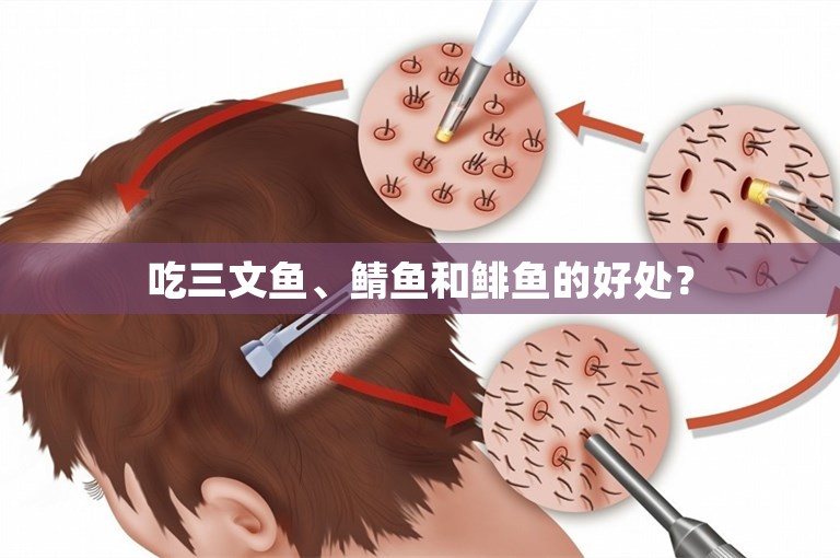 吃三文鱼、鲭鱼和鲱鱼的好处？