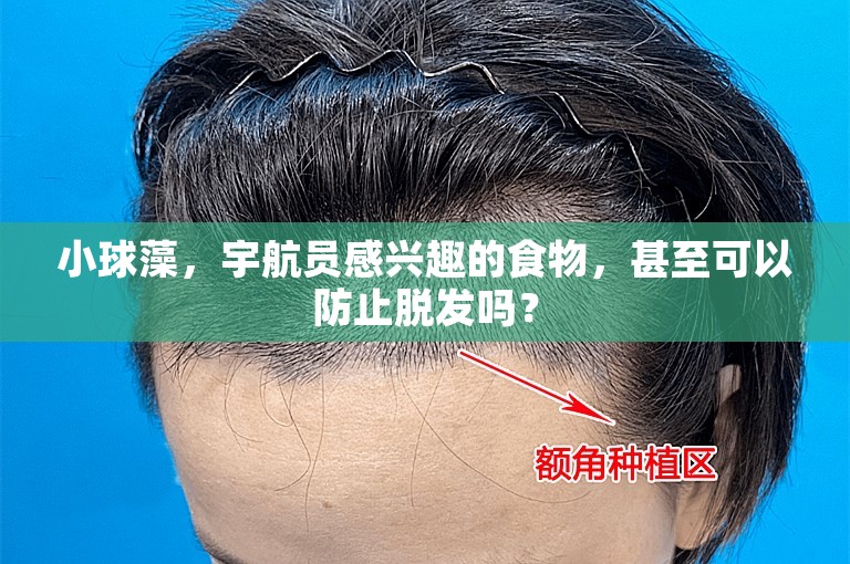 小球藻，宇航员感兴趣的食物，甚至可以防止脱发吗？
