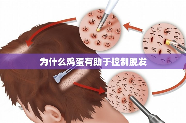为什么鸡蛋有助于控制脱发