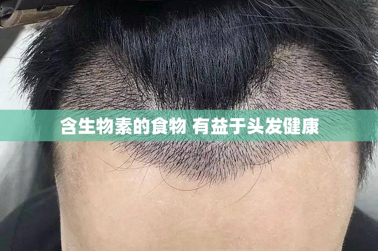 含生物素的食物 有益于头发健康