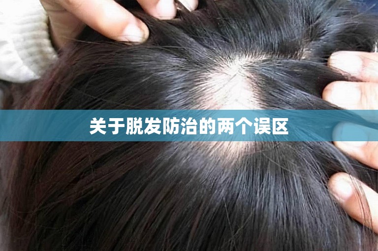 关于脱发防治的两个误区