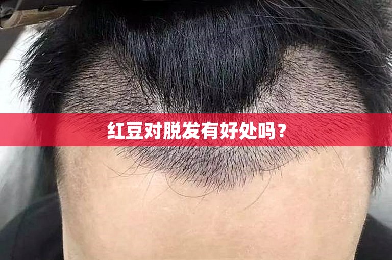 红豆对脱发有好处吗？