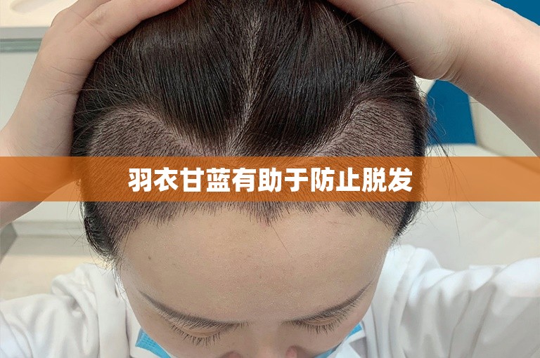 羽衣甘蓝有助于防止脱发