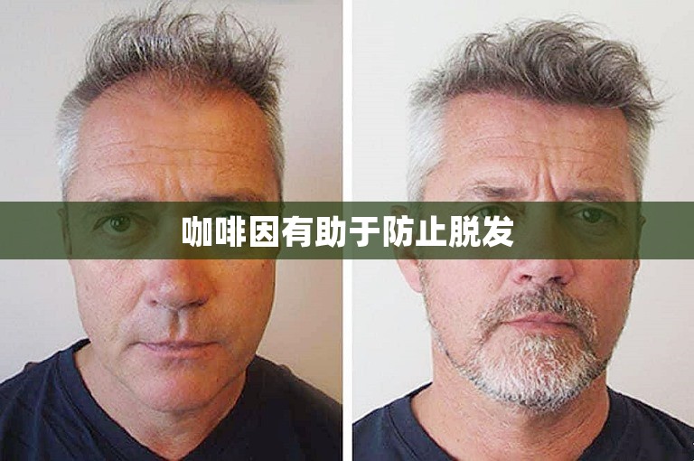 咖啡因有助于防止脱发