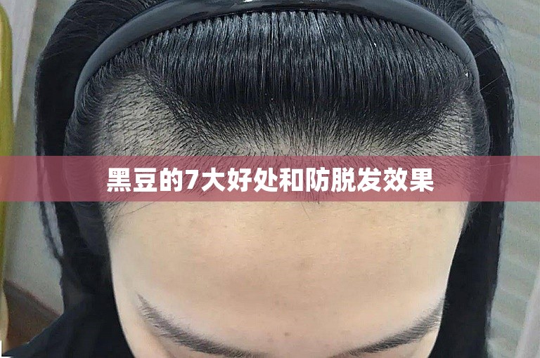 黑豆的7大好处和防脱发效果