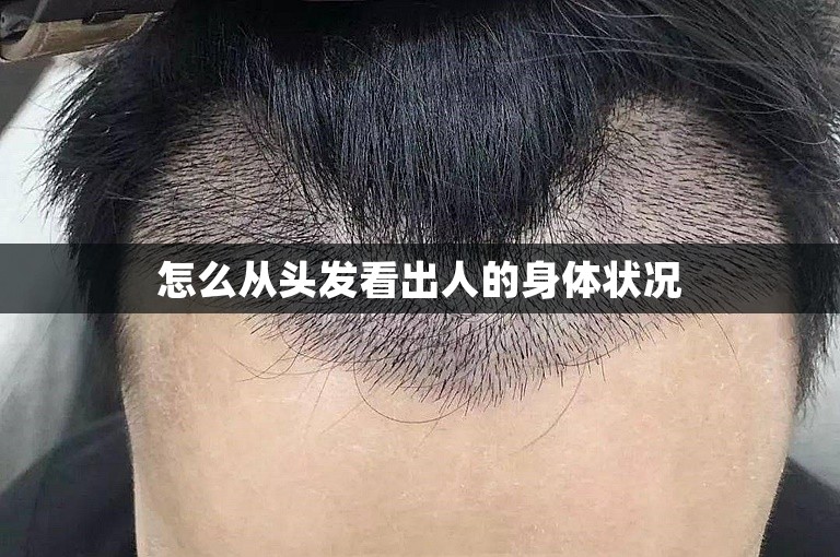 怎么从头发看出人的身体状况