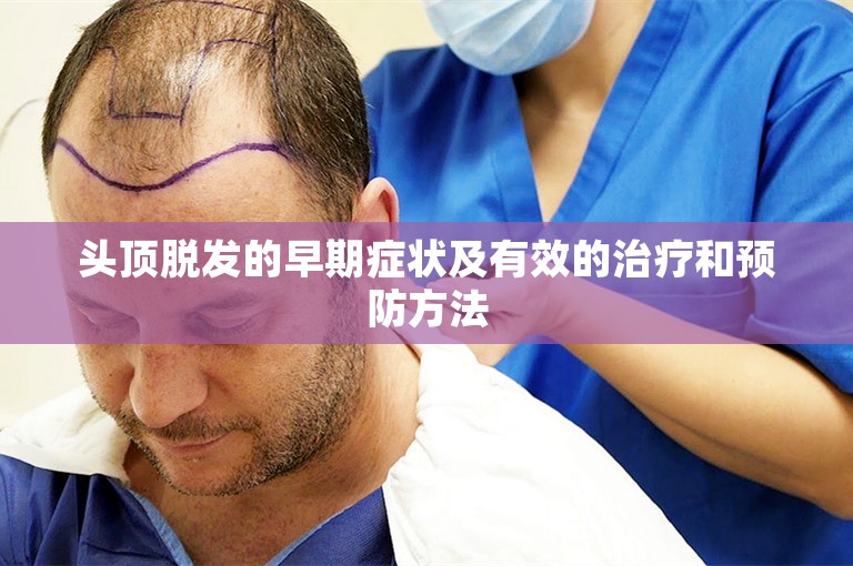 头顶脱发的早期症状及有效的治疗和预防方法 头顶脱发的早期症状及有效的治疗和预防方法