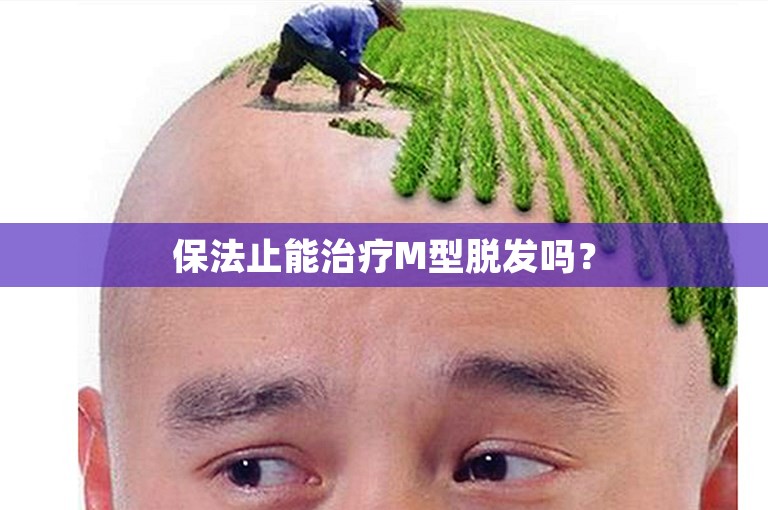 保法止能治疗M型脱发吗? 保法止能治疗M型脱发吗?