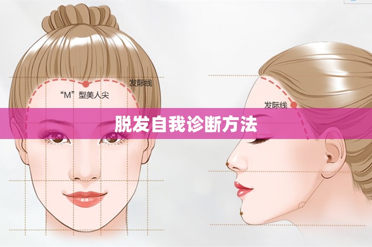 脱发自我诊断方法