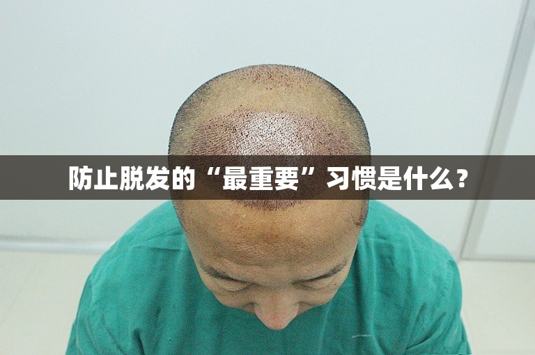 防止脱发的“最重要”习惯是什么？