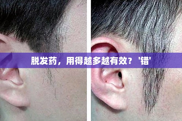脱发药，用得越多越有效？ '错'