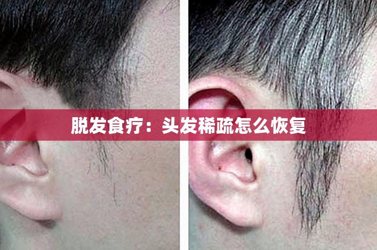 脱发食疗：头发稀疏怎么恢复