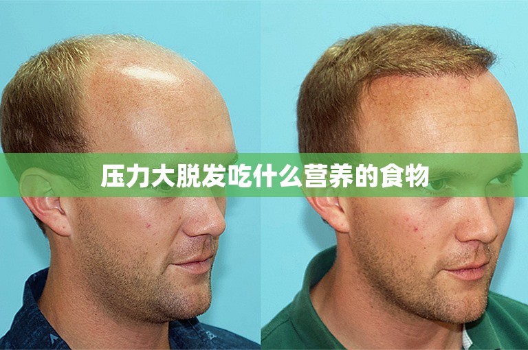 压力大脱发吃什么营养的食物
