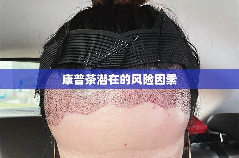 康普茶潜在的风险因素 康普茶潜在的风险因素