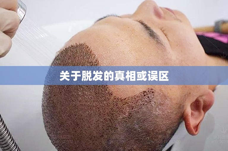 关于脱发的真相或误区