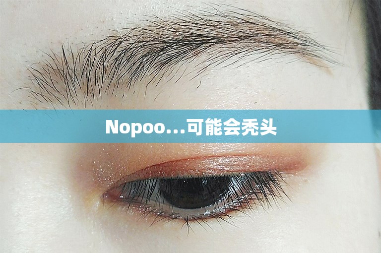 Nopoo...可能会秃头