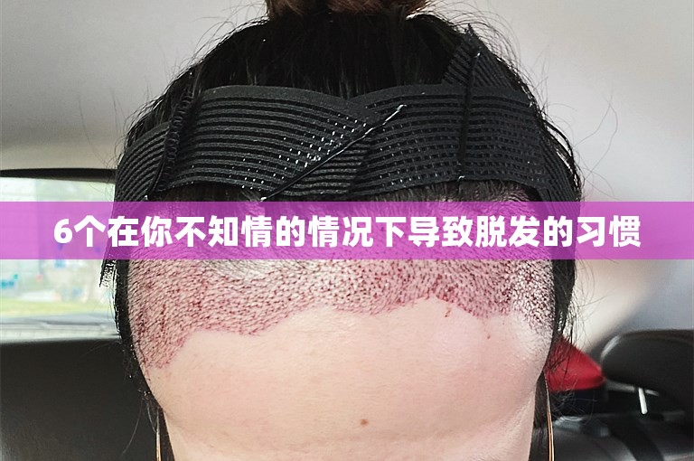 6个在你不知情的情况下导致脱发的习惯