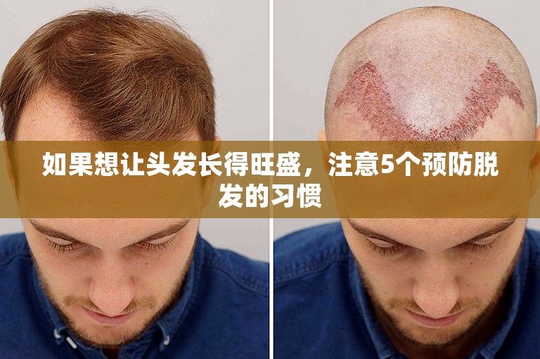 如果想让头发长得旺盛，注意5个预防脱发的习惯