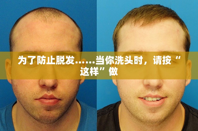 为了防止脱发……当你洗头时,请按“这样”做 为了防止脱发……当你洗头时,请按“这样”做