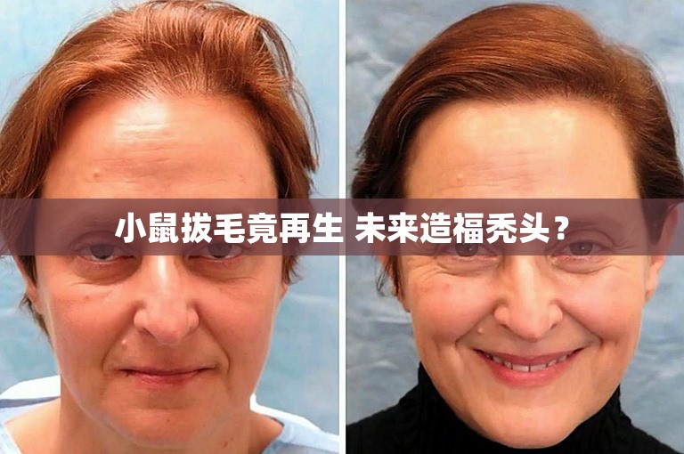 小鼠拔毛竟再生 未来造福秃头？
