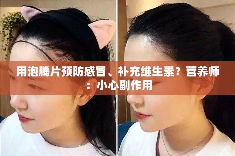 用泡腾片预防感冒、补充维生素？营养师：小心副作用