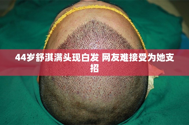 44岁舒淇满头现白发 网友难接受为她支招 44岁舒淇满头现白发 网友难接受为她支招