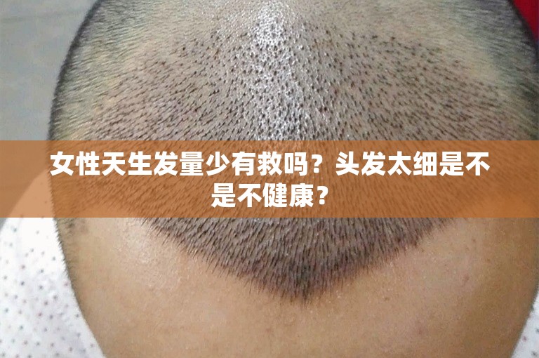 女性天生发量少有救吗？头发太细是不是不健康？